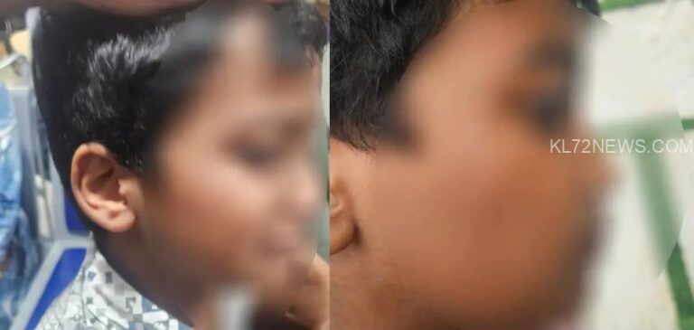 ചികിത്സയ്ക്കിടെ ഡോക്ടർ ഏഴുവയസ്സുകാരനെ മർദിച്ചതായി പരാതി; ഡോക്ടറെ അച്ഛൻ മർദിച്ചെന്ന് ആശുപത്രിയും